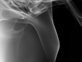 Arstein Smoke-2